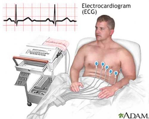 Đo điện tâm đồ (ECG)